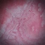 Rhodochrosit 63.91ct. runder Cabochon poliert, ca.33x33x6.5mm